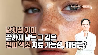 难治性黄褐斑:难以消退的深层真皮色素——治疗的可能性