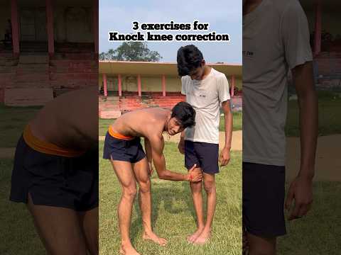 3 exercises for knock knee correction 🏃‍♂️😊❤️#knock #knee #correction