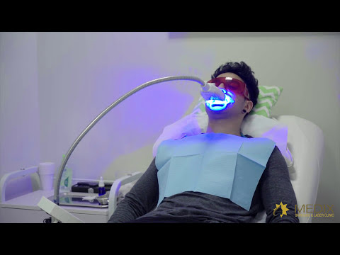 download lagu mp3 mp4 Zoom Teeth Whitening Melbourne Cbd, download lagu Zoom Teeth Whitening Melbourne Cbd gratis, unduh video klip Zoom Teeth Whitening Melbourne Cbd