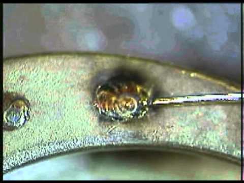 Sisma LM laser Porosity application