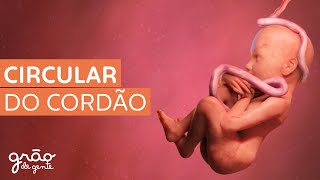 CIRCULAR DO CORDÃO É SEMPRE ARRISCADO?