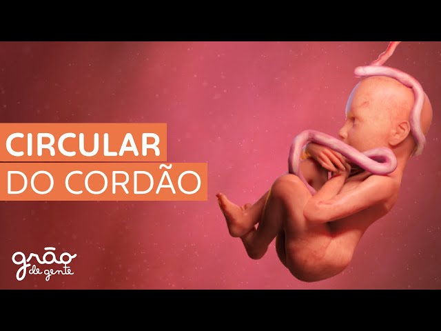 CIRCULAR DO CORDÃO É SEMPRE ARRISCADO?