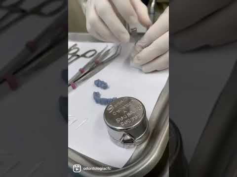 Laboratorio Dental Barranquilla - Diseño de Sonrisa CFC