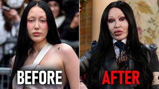 We’re BEGGING These Celebrities To Dissolve Their Filler