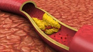 Vrei un sistem cardiovascular sanatos?