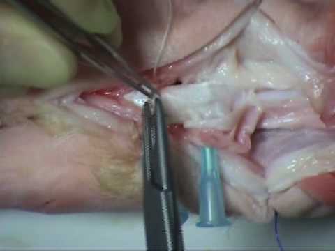 Cum se tratează articulația degetelor