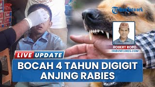 Anjing Liar Serang Bocah di Golo Lambo Manggarai, Korban Alami Luka Parah Telah Divaksin Anti Rabies