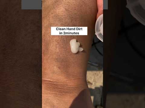 Get Fair Hand Easily At Home/Clean All Dirt Tanning From Hand,Try This Viral Pack #shorts#viral