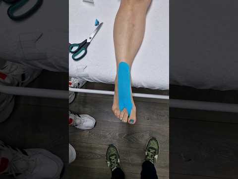Quick Morton's Neuroma Taping Tutorial