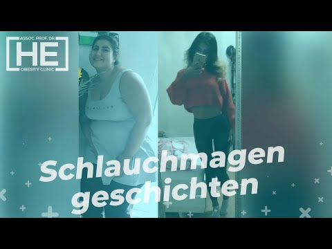 Magenverkleinerung Türkei | Berna hat 74 kg abgenommen in 1 Jahren durch eine Schlauchmagen Op