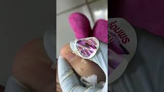 Ep_8477 Foot nails skin removal 👣 ไม่เอาออกก็ไม่จบ 😄 (clip from Thailand)