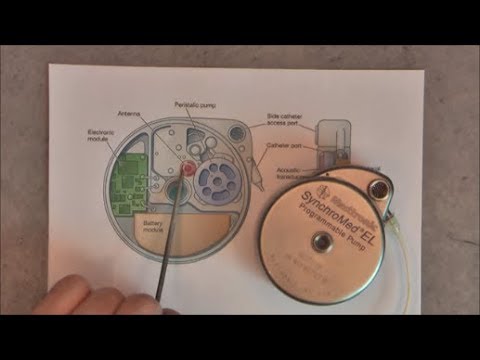 Ebay finds: 1 euro Medtronic SynchroMed EL implantable pump