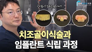 유튜브썸네일