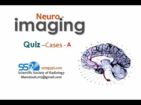 Brain imaging quiz cases (2a) - Prof  Mamdouh Mahfouz