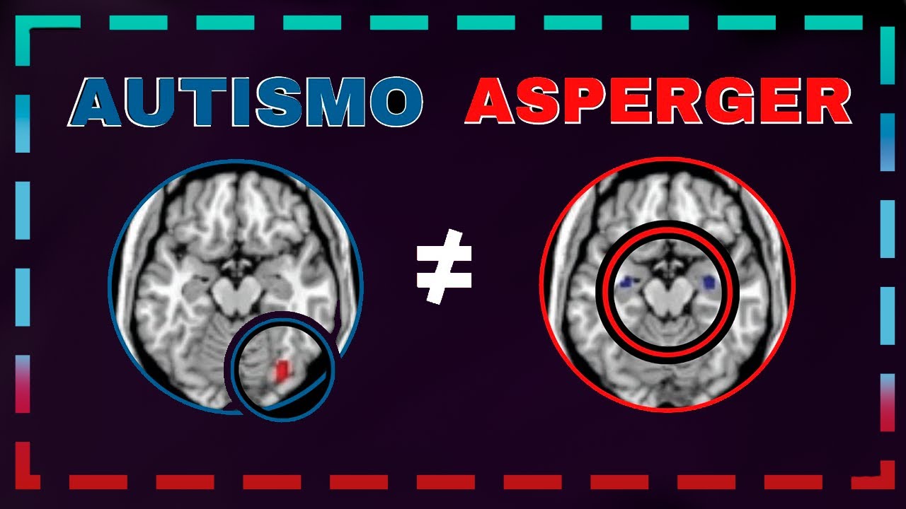 Diferenças entre Autismo e Síndrome de Asperger [CÉREBRO, SINTOMAS E TRATAMENTOS]