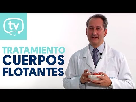 El tratamiento de los cuerpos flotantes