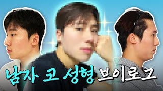 매부리코 성형 브이로그 과연 얼마나 달라졌을지? 남자 코 성형 + 기능 코 성형 후기