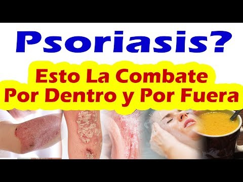 De la corteza que este tal a atopicheskom la dermatitis Atopicheskaya la eccema al niño