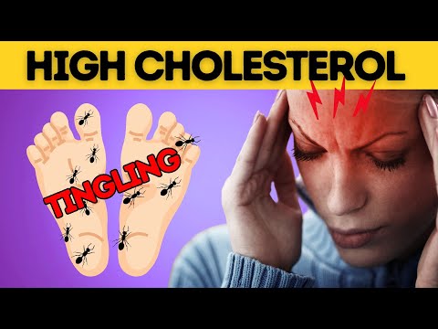 8 Signs of High Cholesterol