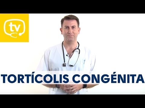 ¿Qué es la tortícolis congénita?