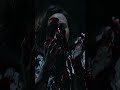 Teaser