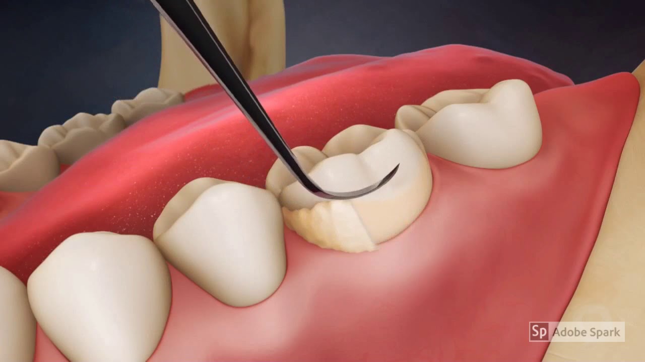 Take a look thumbnail