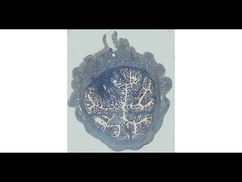 uterine (fallopian) tube