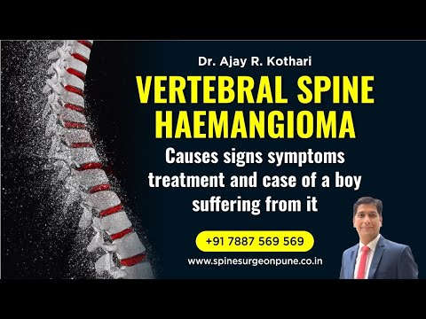 Vertebral spine Haemangioma : causes signs symptoms treatment and case of a boy suffering from it