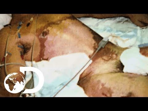 Florida Man Gets Struck By Lightning | Raging Planet