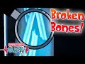Spooky Skeletons and Broken Bones! 🦴 | Science for Kids | Operation Ouch