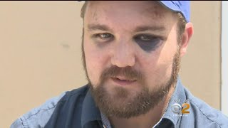 Only On CBS2: Man Attacked In Mid-Wilshire District