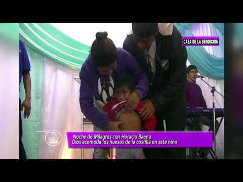 DIOS SANA DEFORMACION EN LA COSTILLA - MILAGRO SOBRENATURAL HORACIO BAENA