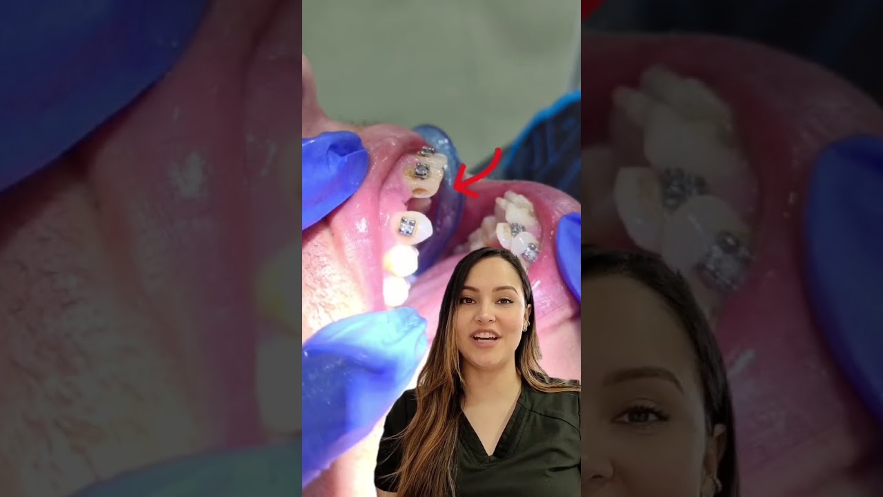 Verónica Alfonso Gallego-14