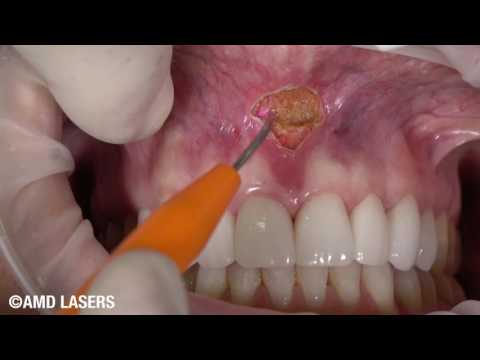 download lagu mp3 mp4 Dr Hornbrook Dentist, download mp3 Dr Hornbrook Dentist free downloadn, video klip Dr Hornbrook Dentist