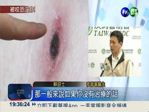 掃墓防恙蟲叮咬 致死率高達6成!