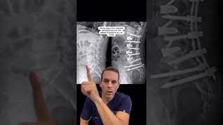 Progressive Spine & Orthopaedics