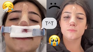 Charli surgery tiktok videos compilation🥺💔