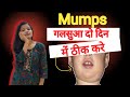 Mumps🧏🏻( गलवा ) Karan , Lakshan , Ilaz || Best Treatment For Mumps ||