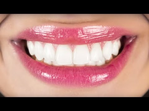 download lagu mp3 mp4 Snyggt Leende, download mp3 Snyggt Leende free downloadn, video klip Snyggt Leende