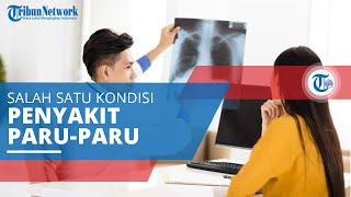 Paru-Paru Basah, Satu dari Sekian Penyakit yang Disebabkan Beberapa Kondisi seperti Adanya Infeksi