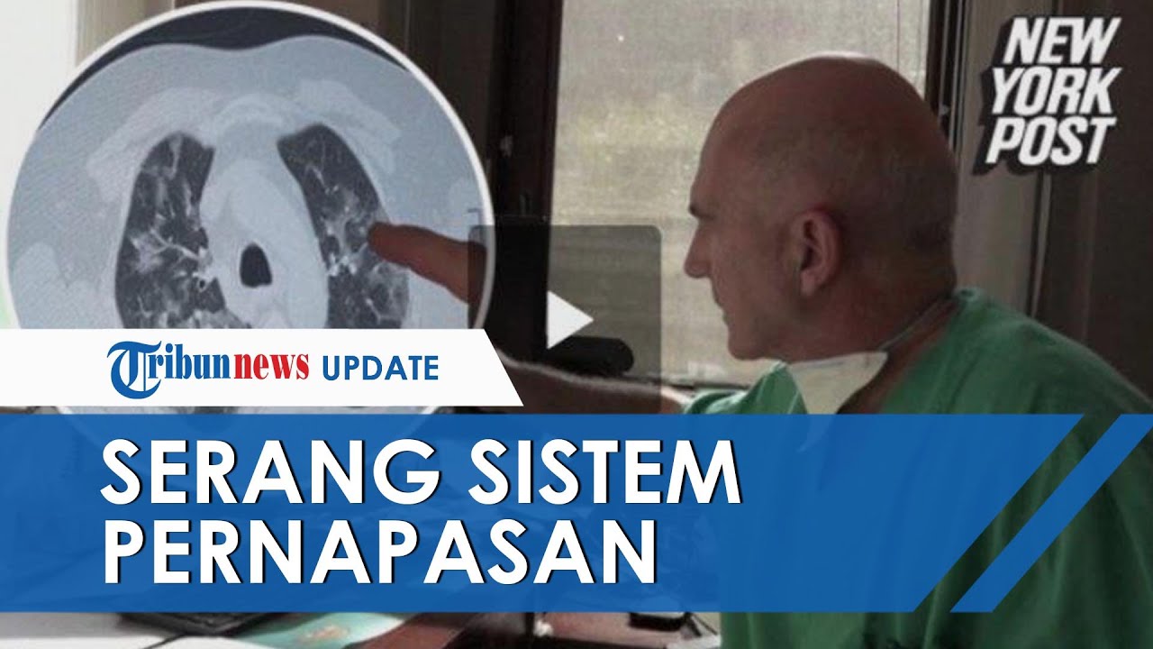 Dampak Covid-19 yang Menyerang Dapat Merusak Sistem Pernapasan, Masyarakat Diimbau Lebih Waspada