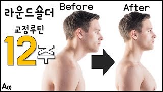 50만명이 효과를 본 라운드숄더 교정루틴 A (by 호주물리치료사)  [피지컬갤러리] (eng sub)