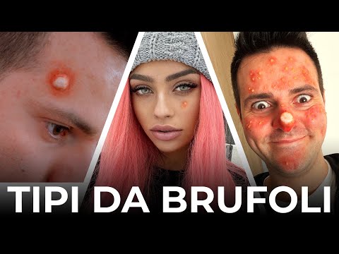 TIPI DA BRUFOLI - PARODIA - iPantellas