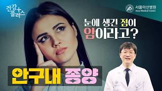 눈에 생긴 점이 암이라고? 안구내 종양 | 건강플러스 미리보기