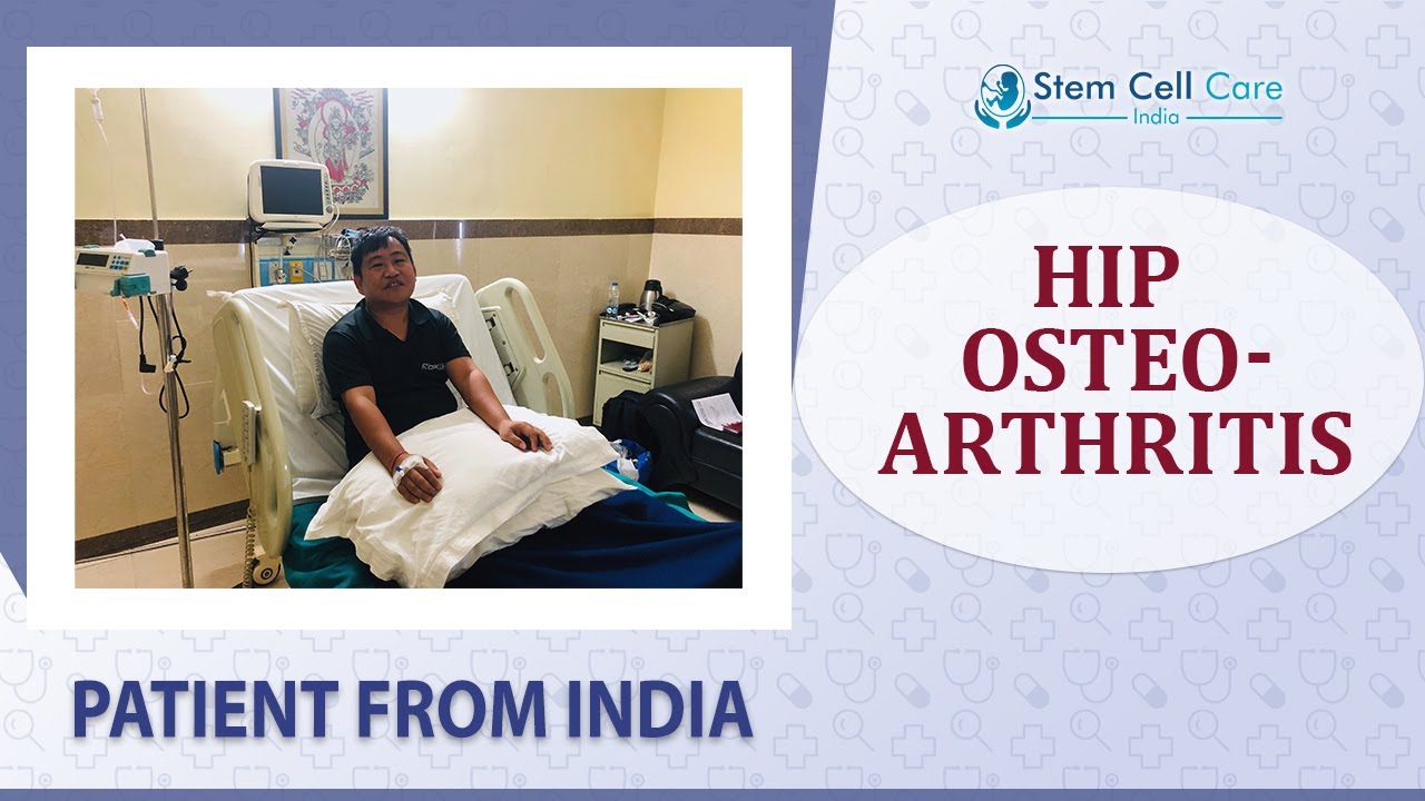 Patient Shares His Experience After Stem Cell Treatment For Hip Osteoarthritis At SCCI | Orthopedic