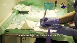La técnica de implanters - José Luis Martínez Meseguer