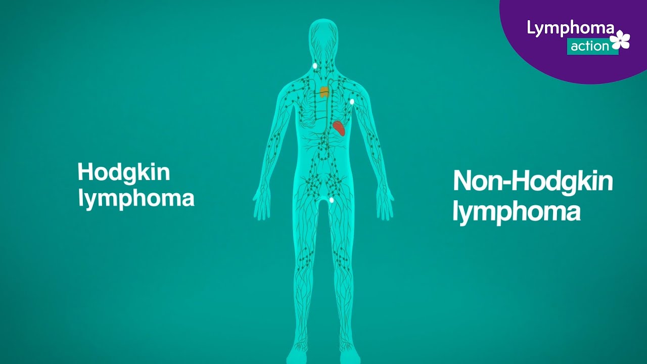 What is lymphoma?