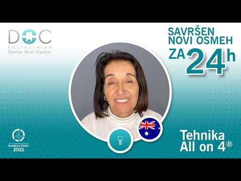 Iskustvo pacijenta - dr Miloš Milošević - ugradnja implantata tehnikom All On 4