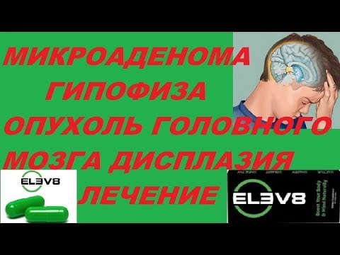 Ноющая боль за левым ухом и шеи Ломит суставы у беременных