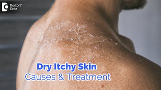 Dry itchy skin all over body. Causes, Diagnosis, Treatment - Dr. Rashmi Ravindra  | Doctors